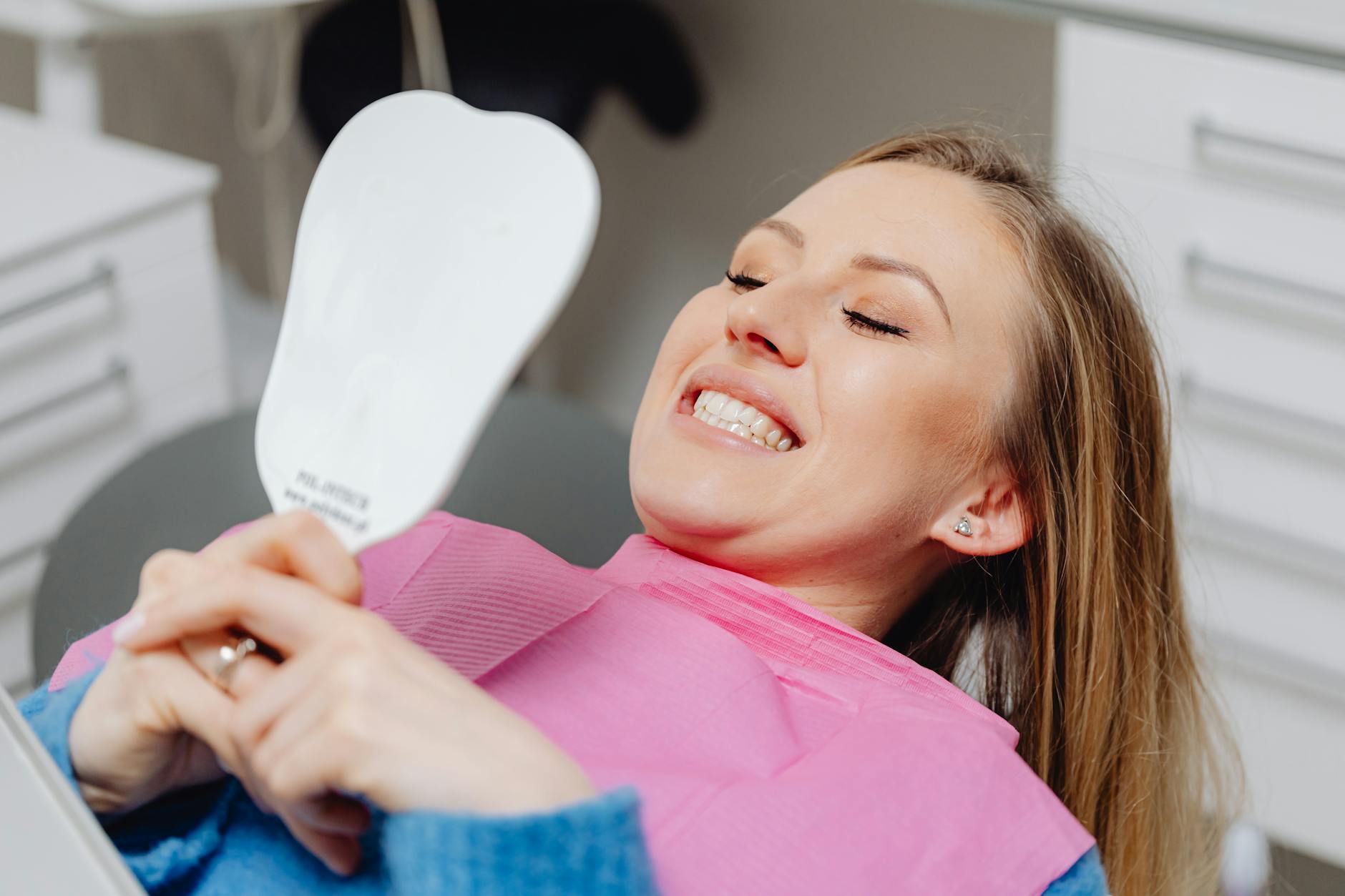 composite-veneers gallery 2
